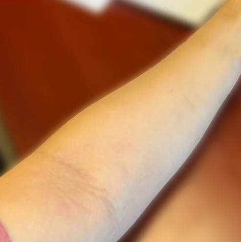 Marisol after, 7 days